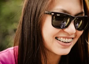 Braces Colours for Your Smile; Here Are Some Suggestions