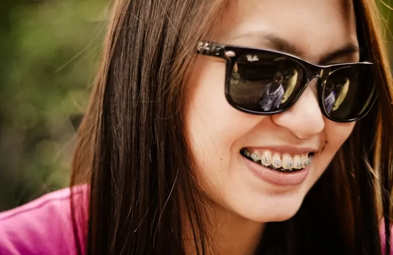 Braces Colours for Your Smile; Here Are Some Suggestions