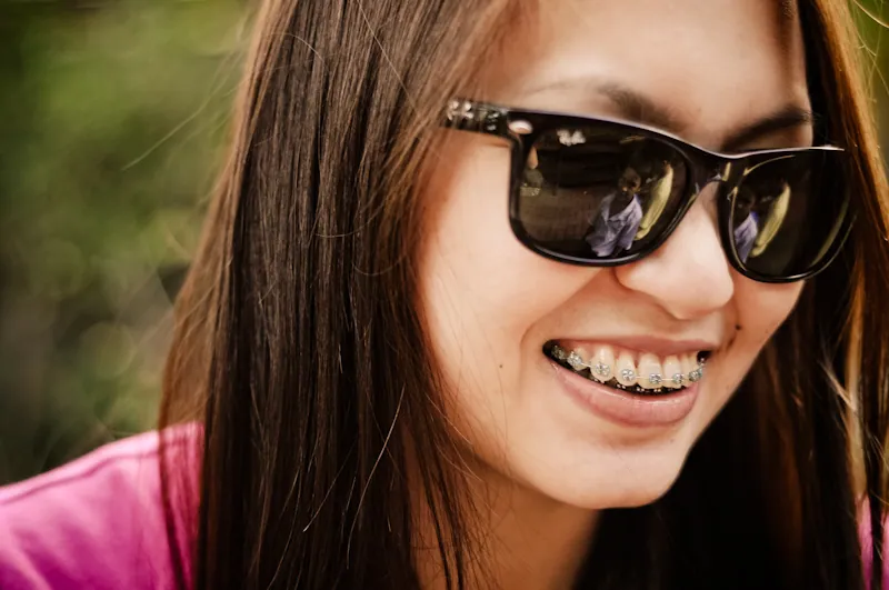 Braces Colours for Your Smile; Here Are Some Suggestions